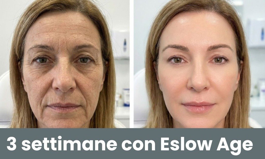 VitaLume - immagine 3